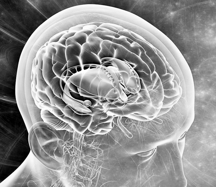 السكتة الدماغية عند كبار السن وكيفية التعامل معها؟ السكتة الدماغية عند كبار السن وكيفية التعامل معها؟