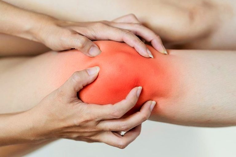 ما هو مضاد الالتهاب الطبيعي الأكثر فعالية لآلام المفاصل؟