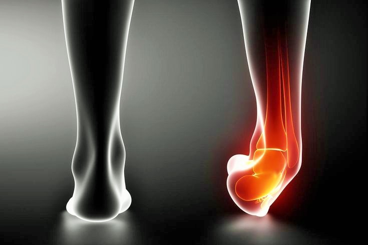 هشاشة العظام في الكاحل  التهاب غير شائع