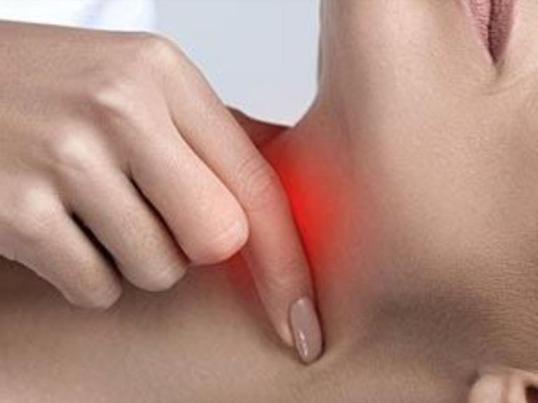 علاجات الجدة طبيعية المضادة لالتهاب الحلق في فصل الصيف