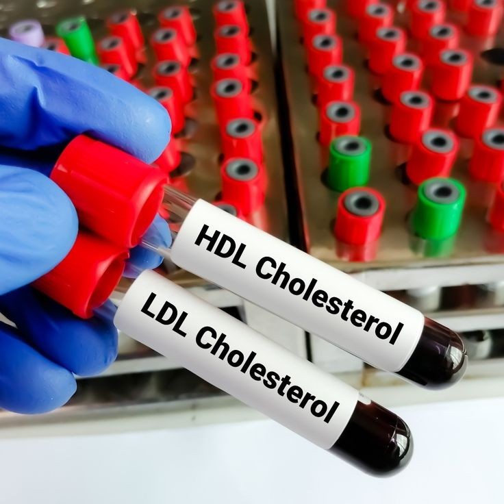 ما الفرق بين الكوليسترول الجيد والكوليسترول السيء؟