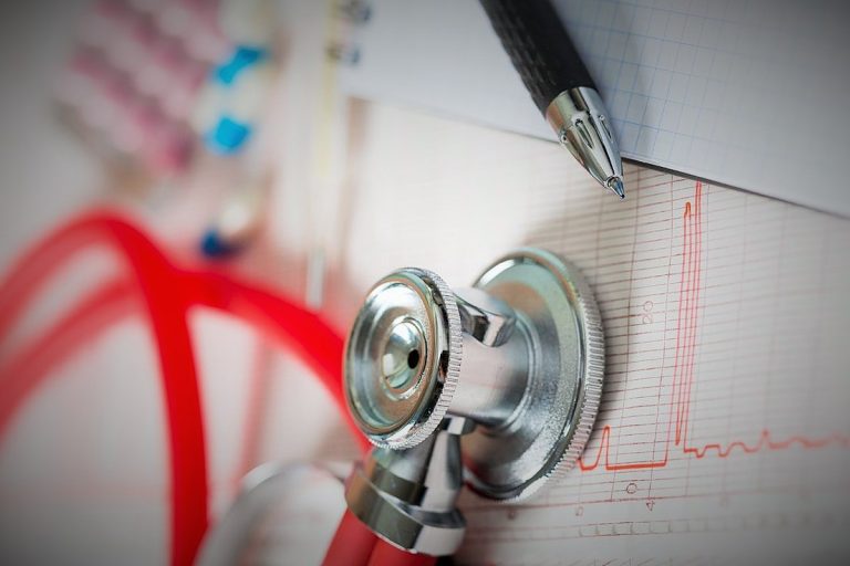 اضطراب نظم القلب ... الانواع والأسباب والوقاية