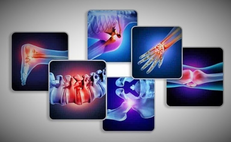 حماية المفاصل ... النصائح والتعليمات