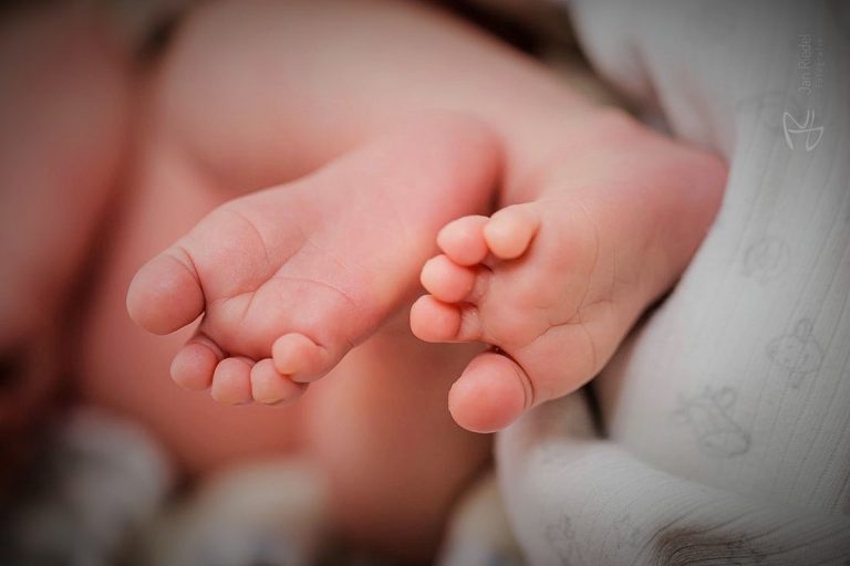 كيفية التعامل مع الحساسية لدى الأطفال؟